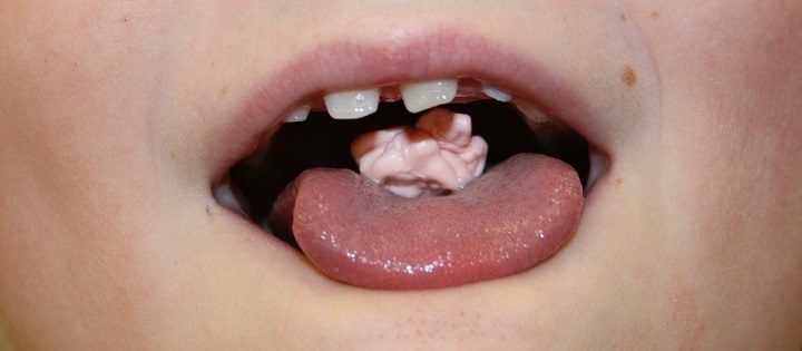 فرایند هضم آدامس در بدن