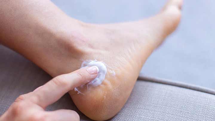 روشهای خانگی برای درمان خشکی پوست پا روشهای خانگی برای درمان خشکی پوست پا