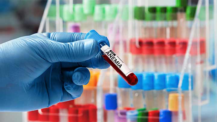 علائم و نشانه‌های کم خونی