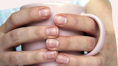 علت ایجاد لکه‌های سفید روی ناخن و روش‌های درمان آن