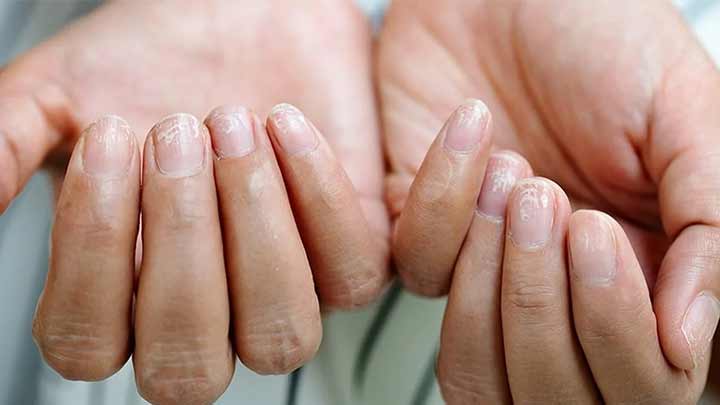 عدم استفاده مکرر از لاک ناخن عدم استفاده مکرر از لاک ناخن