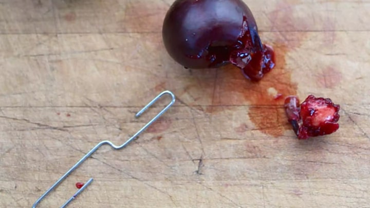 نحوه هسته گیری به کمک سوزن