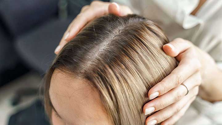 نکات مهم در مصرف شامپوهای ضد ریزش مو نکات مهم در مصرف شامپوهای ضد ریزش مو