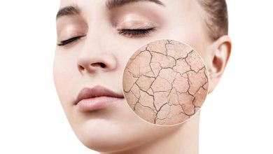 علت خشکی پوست در فصل پاییز و روش‌های درمان آن