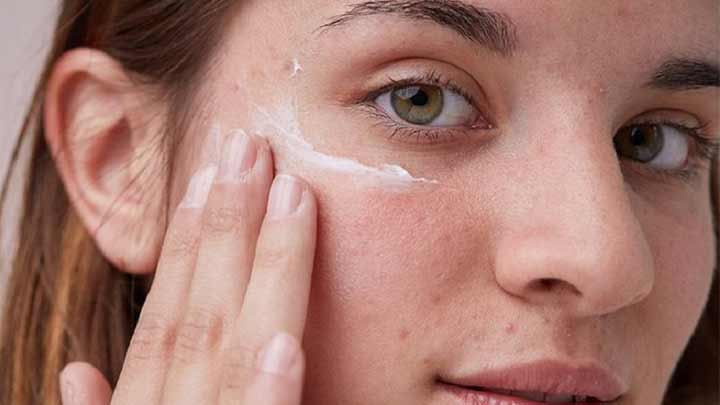 تاثیر ضد آفتاب بر جوش صورت تاثیر ضد آفتاب بر جوش صورت