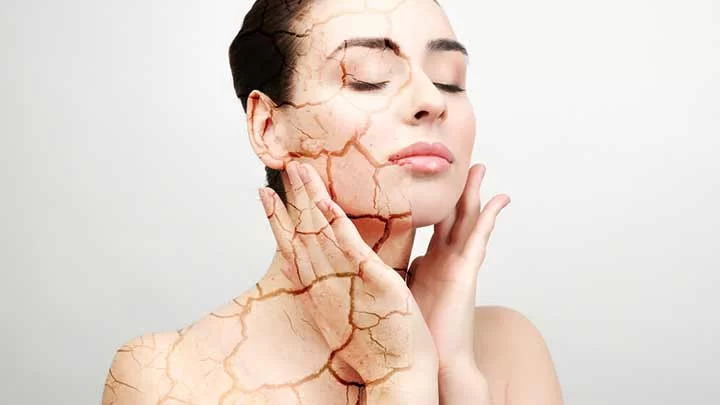 علت خشکی پوست در فصل پاییز و راهکارهای رفع آن علت خشکی پوست در فصل پاییز و راهکارهای رفع آن