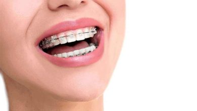 ۴ مورد از بهترین برندهای دهان‌شویه مناسب دندان‌های ارتودنسی