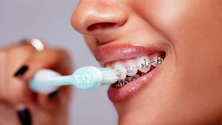 مسواک ارتودنسی کاردنت