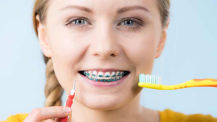 مسواک ارتودنسی منحنی