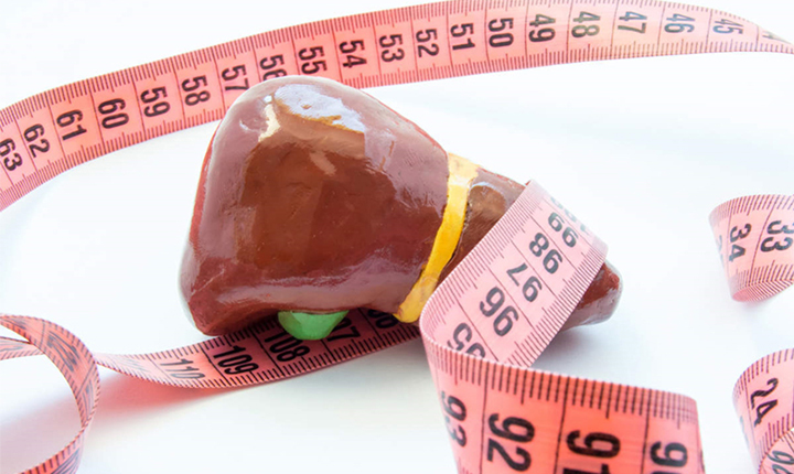 درمان کبد چرب