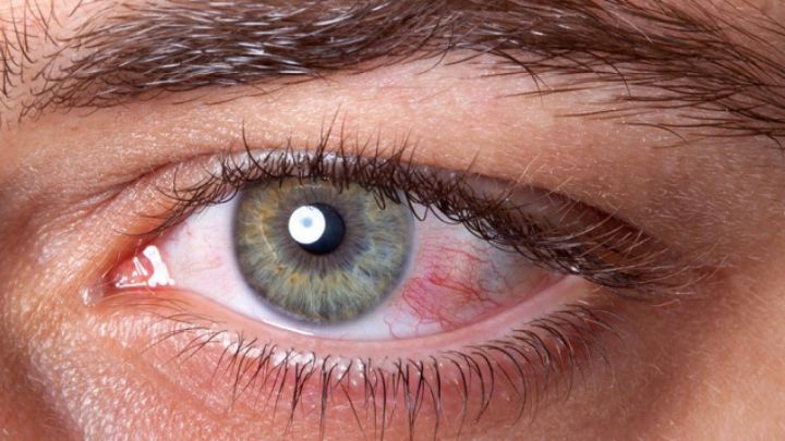 افزایش رطوبت محیط از راهکارهای پیشگیری از خشکی چشم افزایش رطوبت محیط از راهکارهای پیشگیری از خشکی چشم