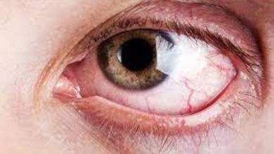 راهکارهای طلایی برای پیشگیری از خشکی چشم