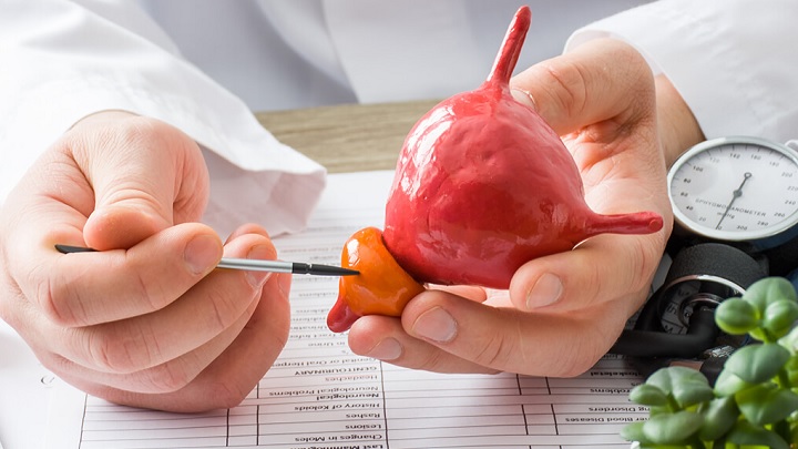 روز جهانی سرطان پروستات روز جهانی سرطان پروستات