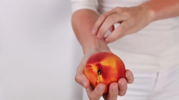 علائم حساسیت به هلو علائم حساسیت به هلو