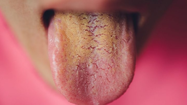 ارتباط ترک زبان و نوشیدن قهوه!