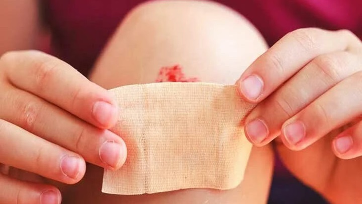 بررسی نحوه درمان زخم با عسل بررسی نحوه درمان زخم با عسل