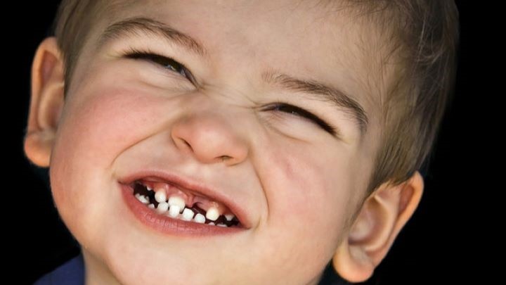 چرا کودکان دندان قروچه می کنند؟ چرا کودکان دندان قروچه می کنند؟