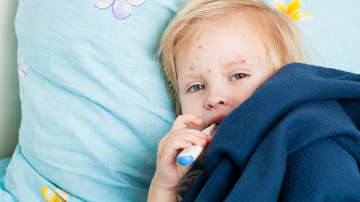 نکاتی که باید در مورد بیماریهای شایع کودکان در فصل تابستان بدانید نکاتی که باید در مورد بیماریهای شایع کودکان در فصل تابستان بدانید