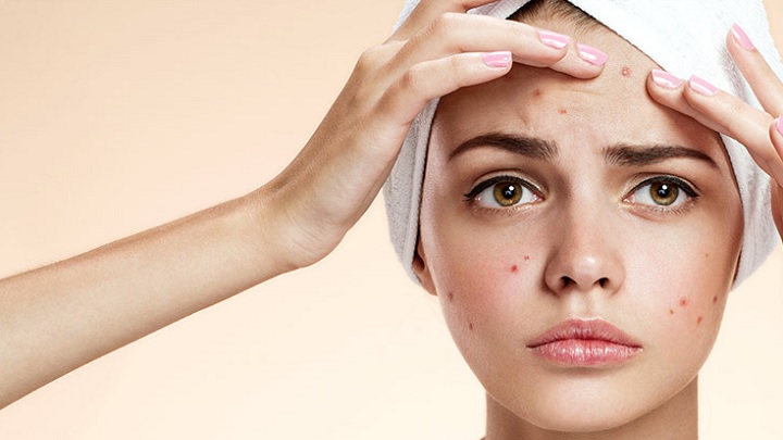 روشن شدن لکههای پوستی با انبه روشن شدن لکههای پوستی با انبه