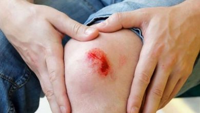 4 درمان خانگی مؤثر برای بهبود سریعتر جای زخم