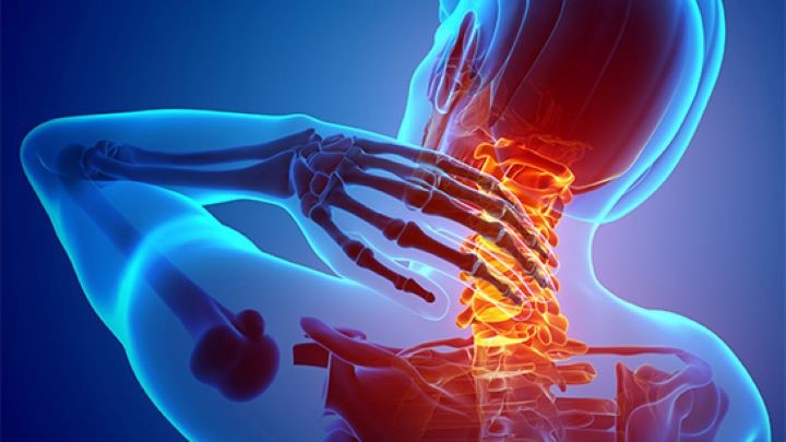 علائم گردن درد علائم گردن درد