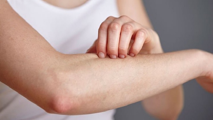 علائم تب دنگی شدید