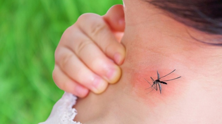 تورم غدد از علائم تب دنگی