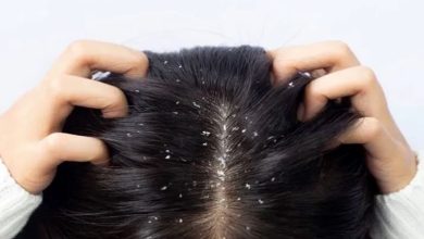 کمبود چه ویتامینی باعث شوره سر می‌شود؟