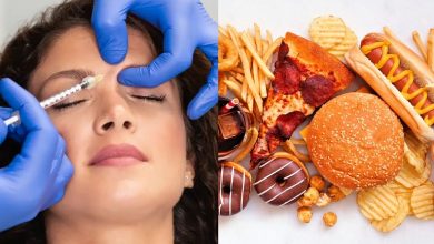 بعد از بوتاکس این 12 ماده غذایی را نخورید