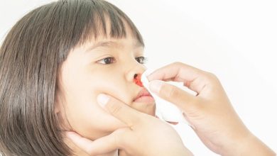 با این ماده خون دماغ را قطع کنید