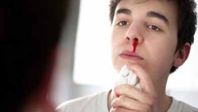 چرا در تابستان دچار خونریزی بینی میشویم؟ + پیشگیری و راهکار