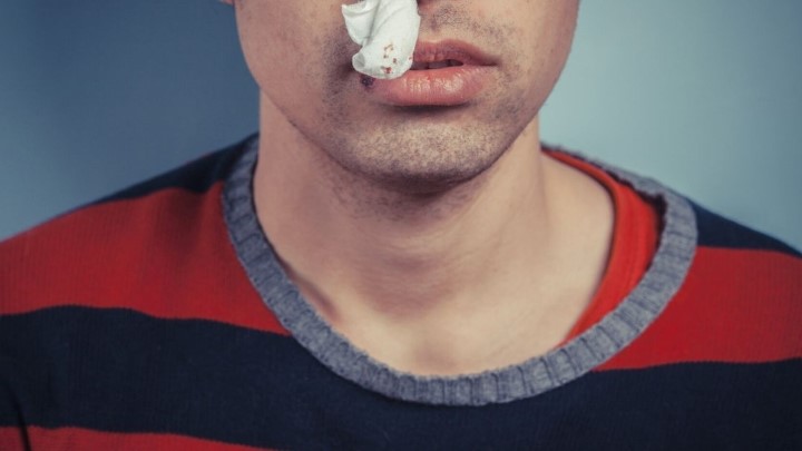 خونریزی از بینی چه زمانی خطرناک است؟ خونریزی از بینی چه زمانی خطرناک است؟