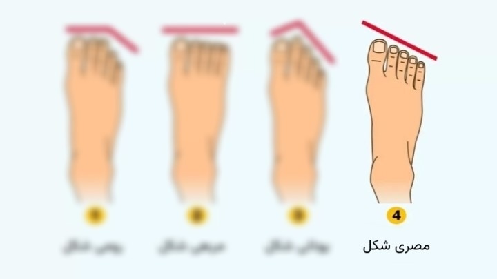 شخصیت پای مصری شکل: اندازه انگشتان پا دارای شیب به ترتیب از بزرگ به کوچک
