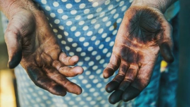 پاک کردن لکههای سیاه گردو با کرم لایه بردار پاک کردن لکههای سیاه گردو با کرم لایه بردار