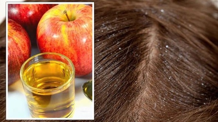 چرا سرکه سیب برای موها مفید است؟ چرا سرکه سیب برای موها مفید است؟