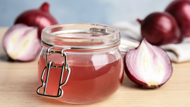 معجزه پیاز و عسل در درمان ریزش مو