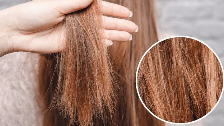 درمان موخوره با سرکه سیب درمان موخوره با سرکه سیب