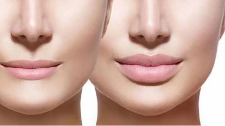 بهترین روشهای آرایشی رفع افتادگی گوشه لب بهترین روشهای آرایشی رفع افتادگی گوشه لب