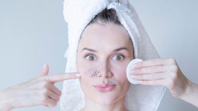 10 روش طبیعی از بین بردن جوش‌های سرسیاه روی بینی