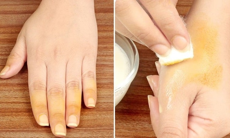 روشهای ساده برای پاک کردن لکه زردچوبه از ناخن و دست؛ Methods for removing turmeric stains from nails and hands