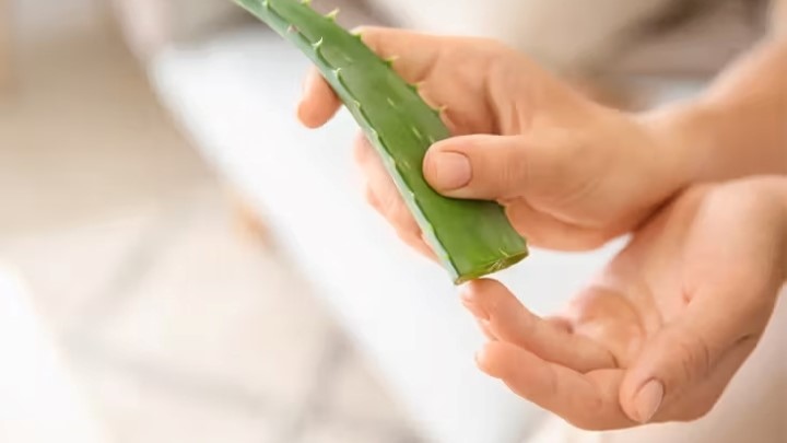 درمان جوش گرمازدگی در خانه با آلوئه‌ورا
